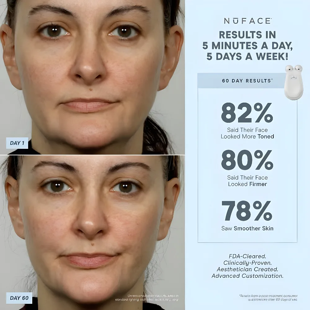 NuFACE Trinity Effective Lip and Eye (ELE) Attachment - Image 4