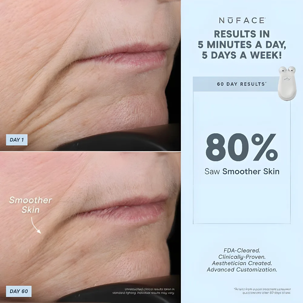 NuFACE Trinity Effective Lip and Eye (ELE) Attachment - Image 3